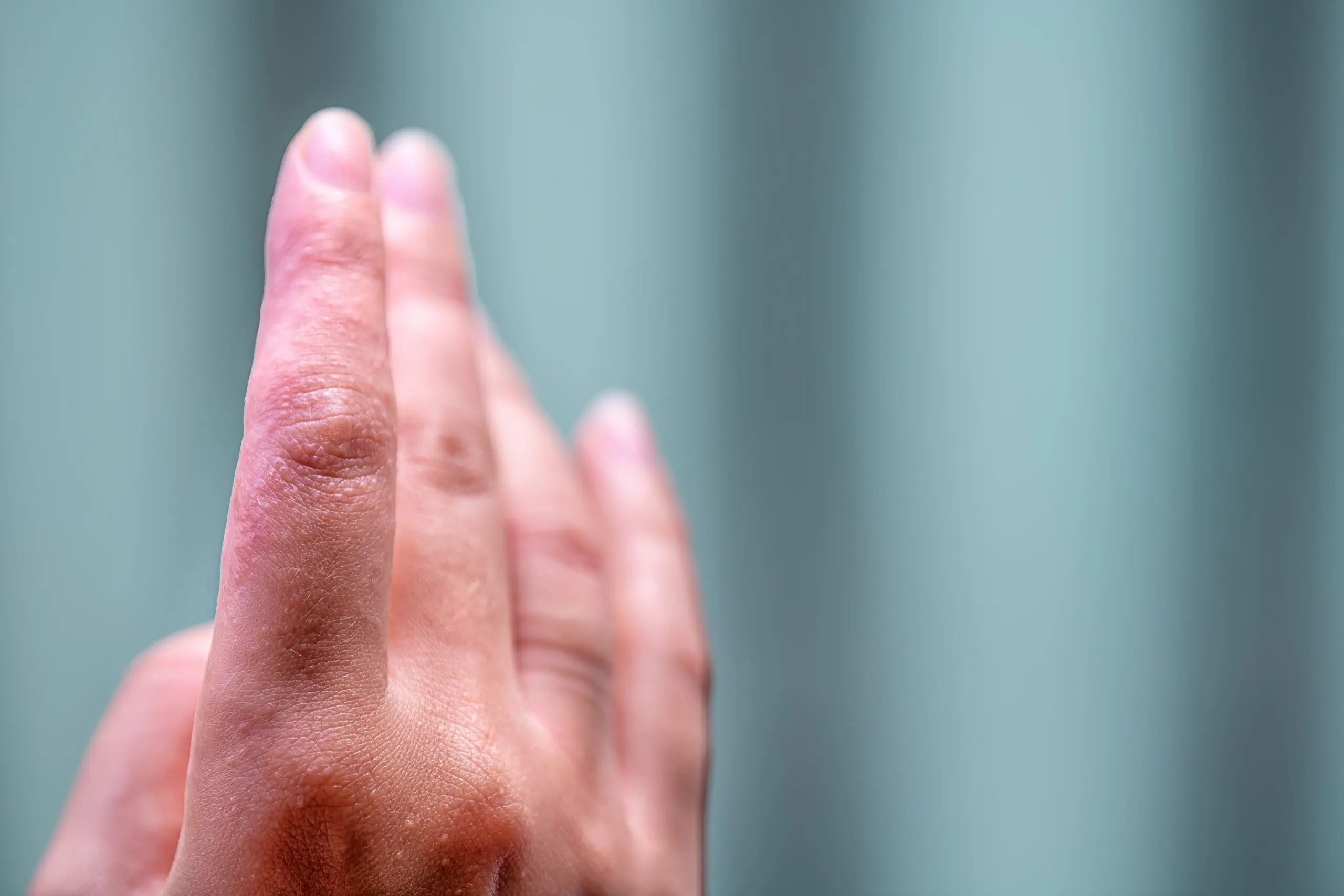 reakcja alergiczna na nikiel
