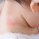 AZS u dzieci - kompletny poradnik dla rodziców