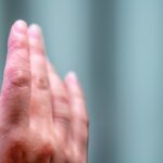 reakcja alergiczna na nikiel